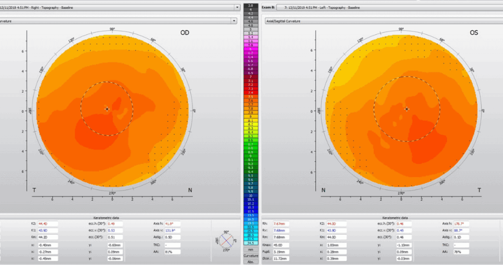 Topography 1