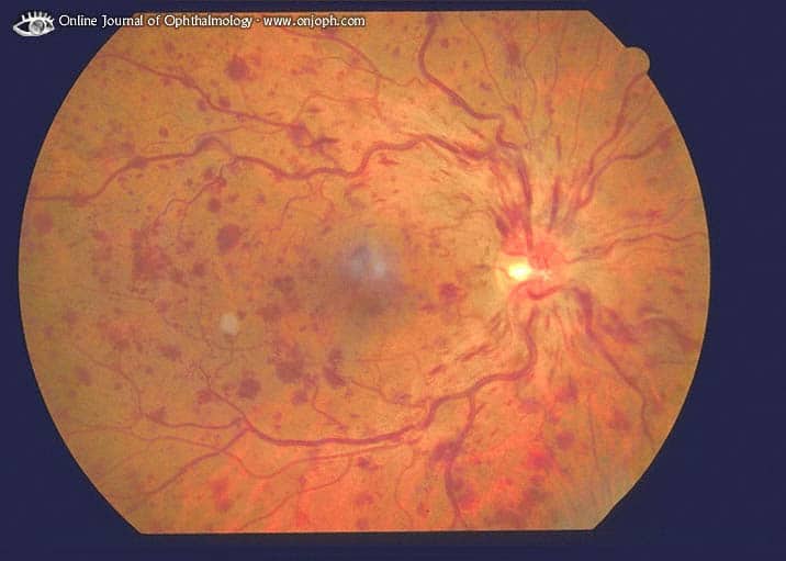 SRC Mini: How COVID infection can impact the eyes - Canterbury Eyecare